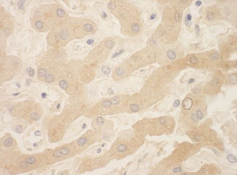 APOH / Apolipoprotein H Antibody