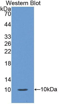S100A12 Antibody (aa1-92)