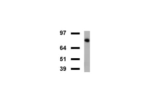 FOLH1 / PSMA Antibody (clone UMAB26)