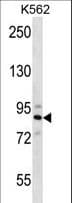 IHC-plus™ Polyclonal Rabbit anti-Human STRN4 Antibody (aa124-153, IHC, WB)