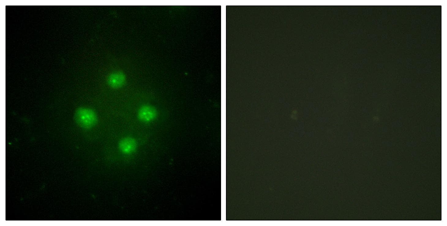 Polyclonal Rabbit anti-Human MED24 / TRAP100 Antibody (IF, WB)