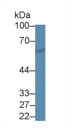 SPTLC2 / LCB2 Antibody (aa453-560)