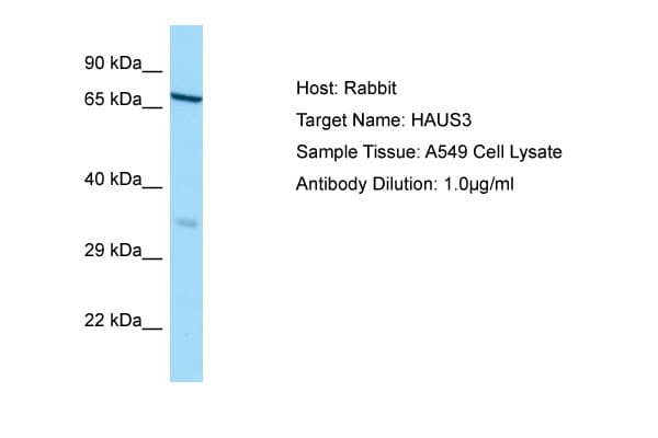 Polyclonal Rabbit anti-Human HAUS3 / C4orf15 Antibody (aa138-187, WB)