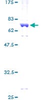 Human PRKACG Protein (Recombinant GST)