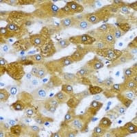 RPL9 / Ribosomal Protein L9 Antibody