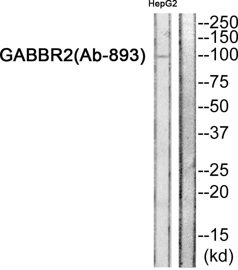 GABBR2 / GABA B Receptor 2 Antibody