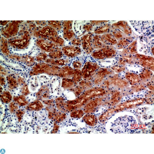 DROSHA / RNASEN Antibody