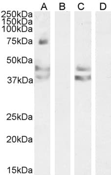 Polyclonal Goat anti-Human AGTR1 / AT1 Receptor Antibody (Internal Region, WB)