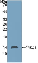 Human AMH / Anti-Mullerian Hormone Protein (Recombinant His, N-Terminal)