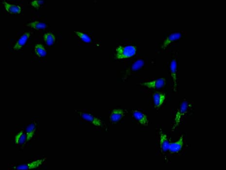 HSPC167 / CDK5RAP1 Antibody