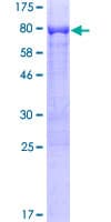Human RARA / RAR Alpha Protein (Recombinant GST)