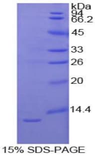 Human IL1R1 Protein (Recombinant His)