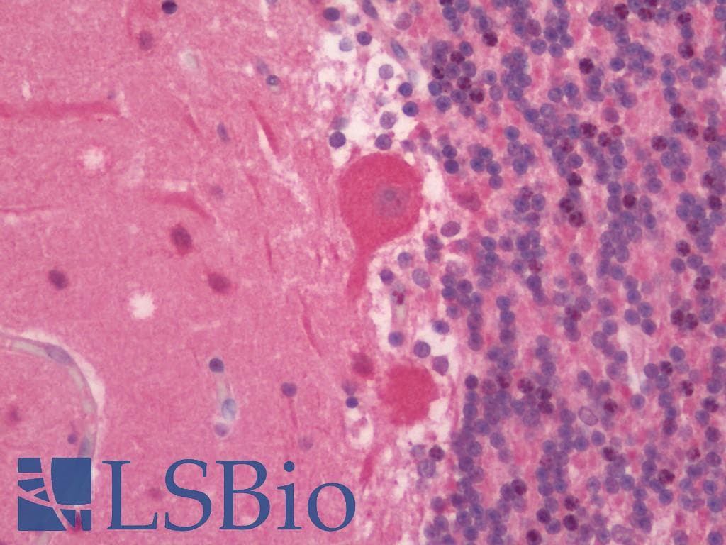IHC-plus™ Polyclonal Rabbit anti-Human APG5 / ATG5 Antibody (aa1-30, IHC, IF, WB)