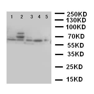 TP63 / p63 Antibody (aa664-680)