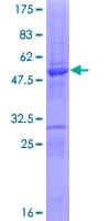 Human SERTAD3 Protein (Recombinant GST)