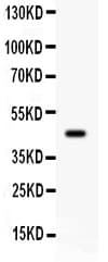 ADRB2 Antibody (aa221-256)