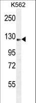 AASS / LKR / SDH Antibody (aa805-834)