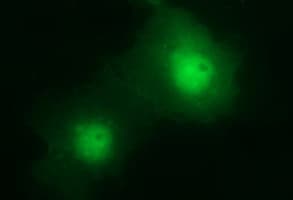 CHAC1 / MGC4504 Antibody (clone OTI1G1)