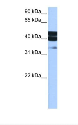 Polyclonal Rabbit anti-Human SMAD1 Antibody (aa153-202, IHC, WB)