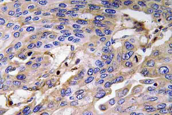 Polyclonal Rabbit anti-Human HP / Haptoglobin Antibody (Val328, IHC)
