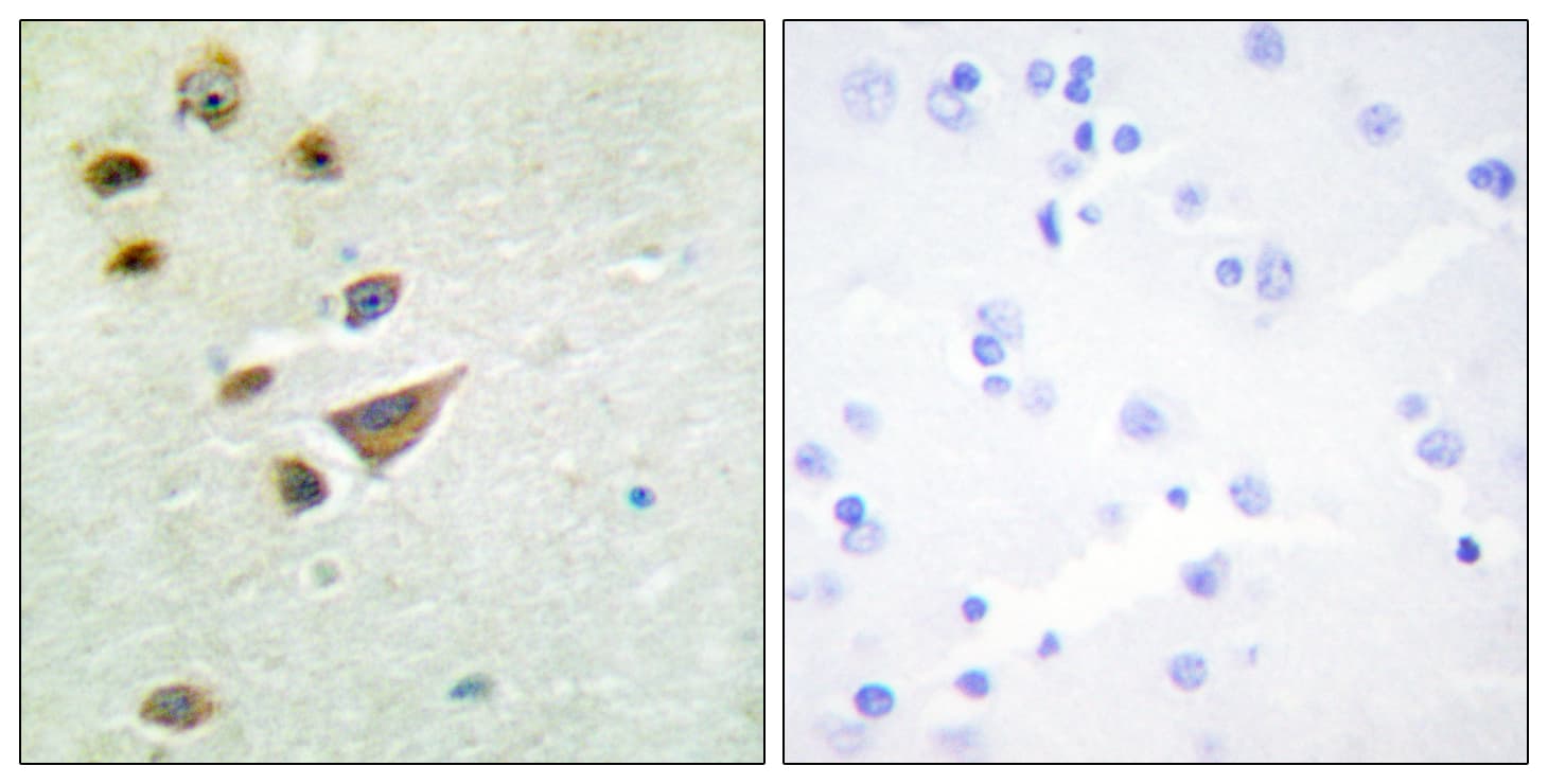 NT5C3A Antibody (aa11-60)