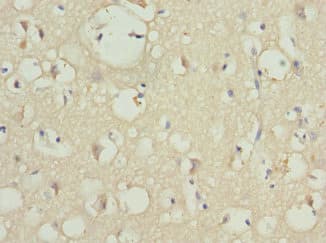 PIP5K1B Antibody