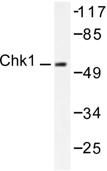 Polyclonal Rabbit anti-Human CHEK1 / CHK1 Antibody (Lys274, WB)