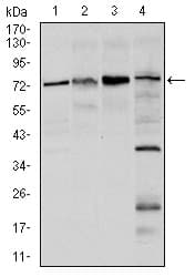 FOXO1 / FKHR Antibody (clone 3B6)