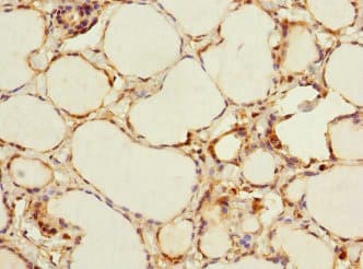 Polyclonal Rabbit anti-Human ADCY4 / Adenylate Cyclase 4 Antibody (IHC)
