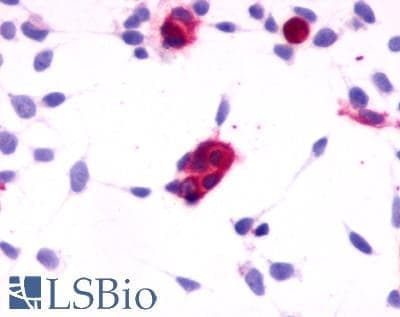 PathPlus™ Polyclonal Rabbit anti-Human CNR1 / CB1 Antibody (Cytoplasmic Domain, IHC)