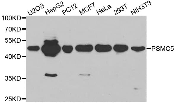 Polyclonal Rabbit anti-Human PSMC5 / SUG1 Antibody (IHC, IF, WB)