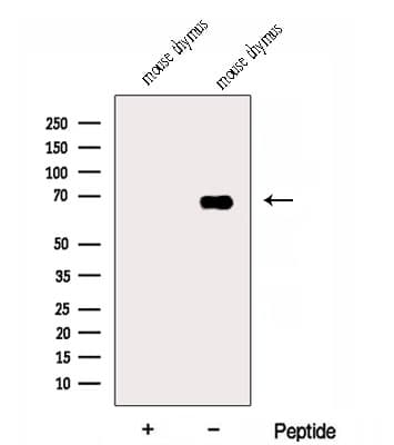 Dipeptidyl Peptidase 3 / DPP3 Antibody