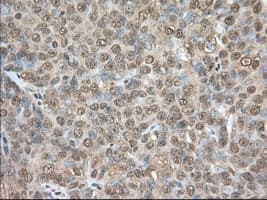 PDE4A / PDE4 Antibody (clone OTI7B11)