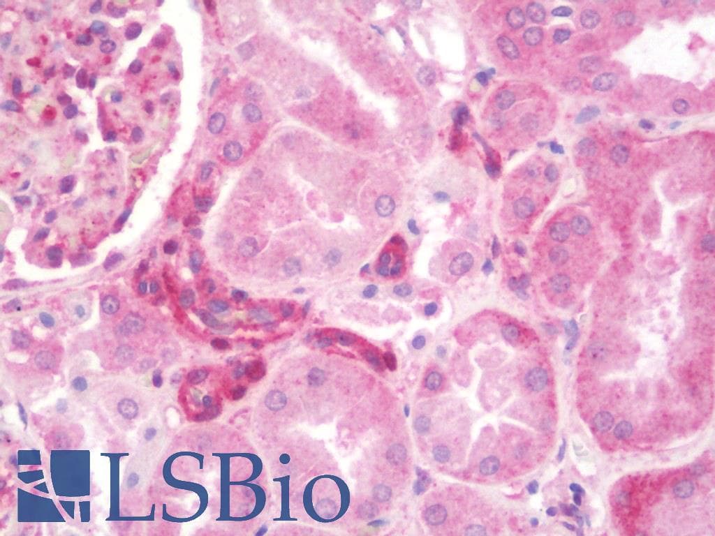 IHC-plus™ PRMT4 / CARM1 Antibody