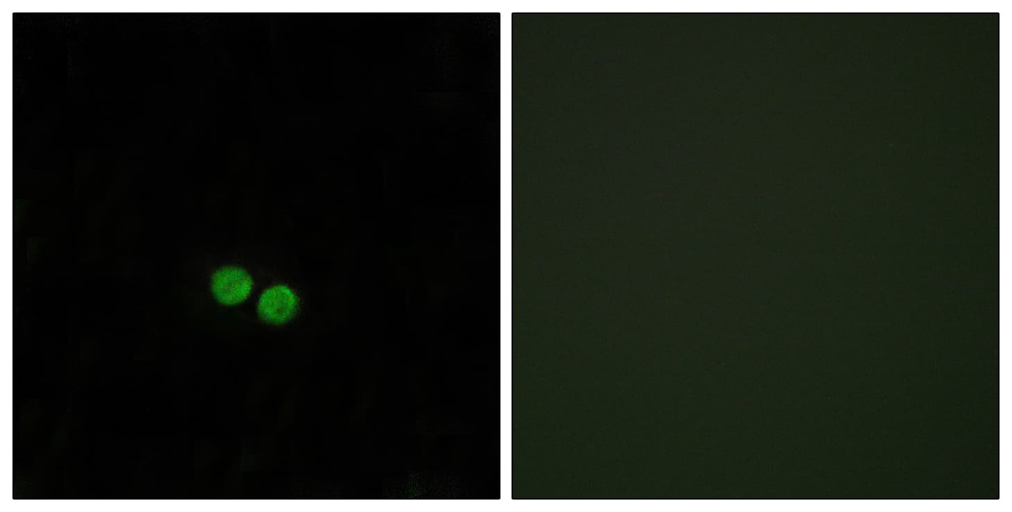 Polyclonal Rabbit anti-Human CDC25C Antibody (aa14-63, IHC, IF)