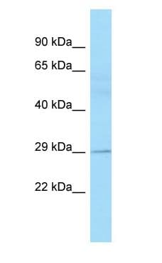 EAF2 / U19 Antibody (aa187-236)