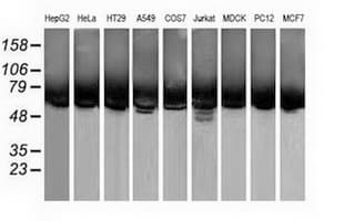 Monoclonal Mouse anti-Human CALCOCO2 Antibody (clone OTI2D11, IF, WB)