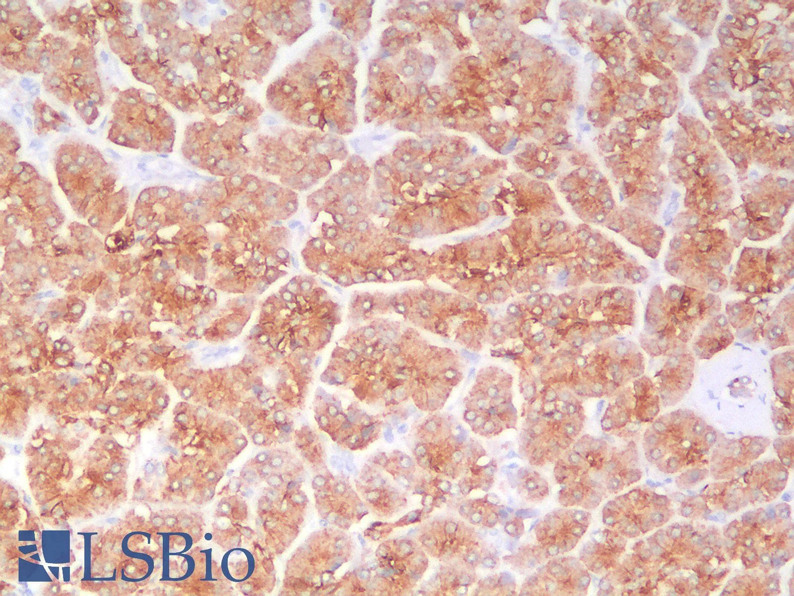 IHC-plus™ KRT18 / CK18 / Cytokeratin 18 Antibody (clone KRT18/2819R)
