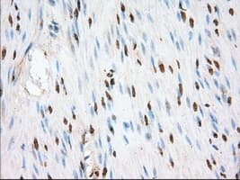 ERIC-1 / TACC3 Antibody (clone OTI6C6)