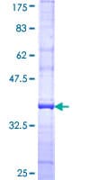 Human CMAH Protein (Recombinant GST, N-terminus)