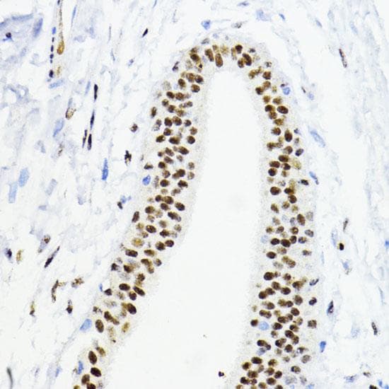 ZEB1 / AREB6 Antibody