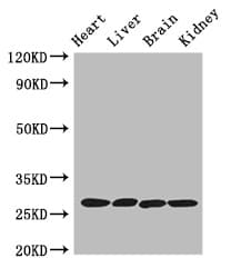 IHC-plus™ PRSS2 / Trypsin 2 Antibody