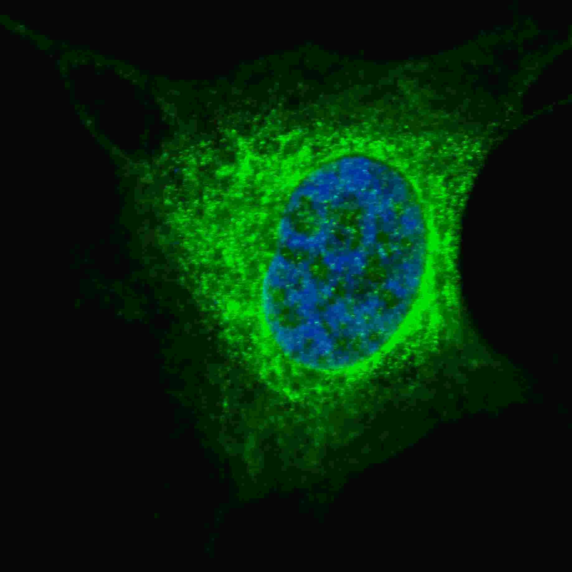 Vimentin Antibody (Ser82)