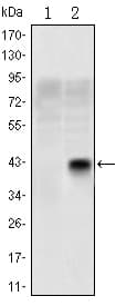 Monoclonal Mouse anti-Human OLIG2 Antibody (clone 1G11, IHC, IF, WB)