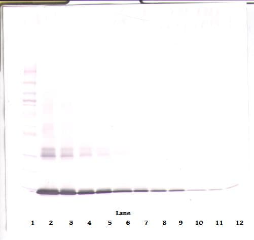 CSF2 / GM-CSF Antibody (Biotin)