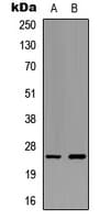 Polyclonal Rabbit anti-Human EFNA5 / Ephrin A5 Antibody (Internal, IHC, IF, WB)