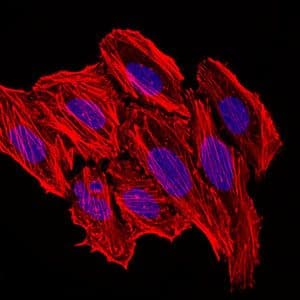 Monoclonal Mouse anti-Human CCL2 / MCP1 Antibody (clone 2D8, IHC, IF, WB)