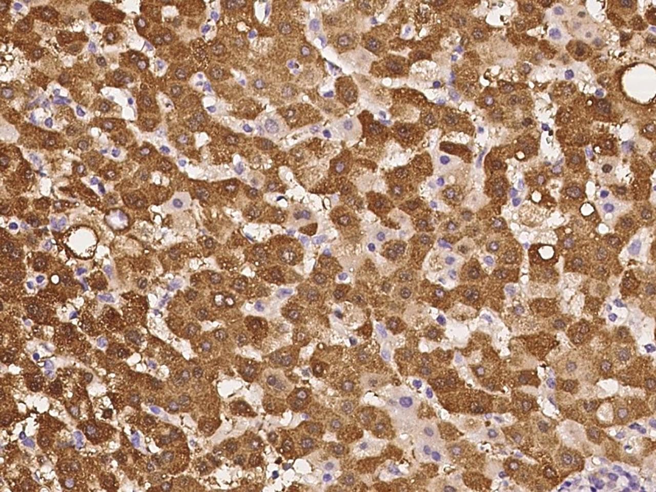 PPIP5K2 / HISPPD1 Antibody