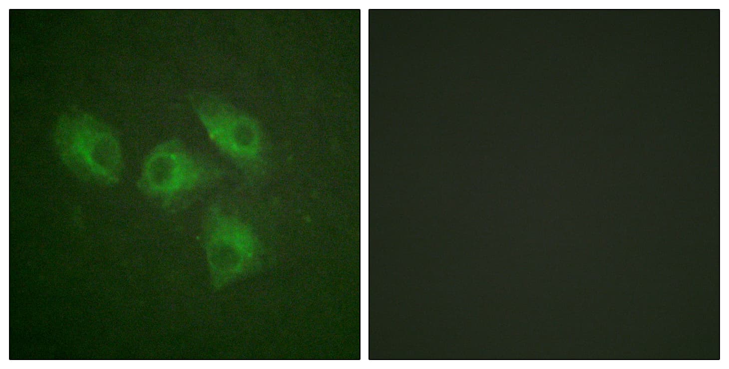 PIK3R1 / p85 Alpha Antibody (aa573-622)