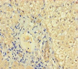 KRT71 / Keratin 71 Antibody